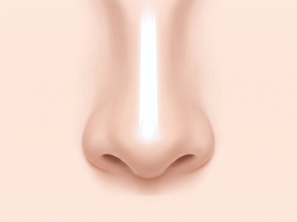 정면에서 본 코 일러스트 — 얇은 콧등 피부 아래로 보형물 윤곽이 비쳐 보이는 모습
